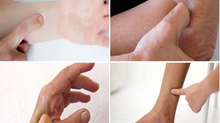 Acupressure Treatment to Heal 8 Most Common Body Pains 